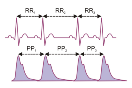 ECG and PPG signals used in Heart Rate Variability Analysis